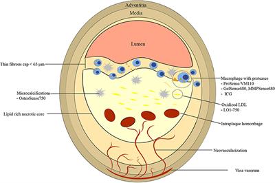 Intravascular Molecular Imaging: Near-Infrared Fluorescence as a New Frontier